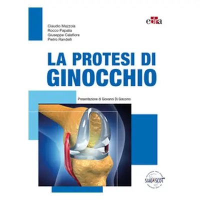 La protesi di ginocchio